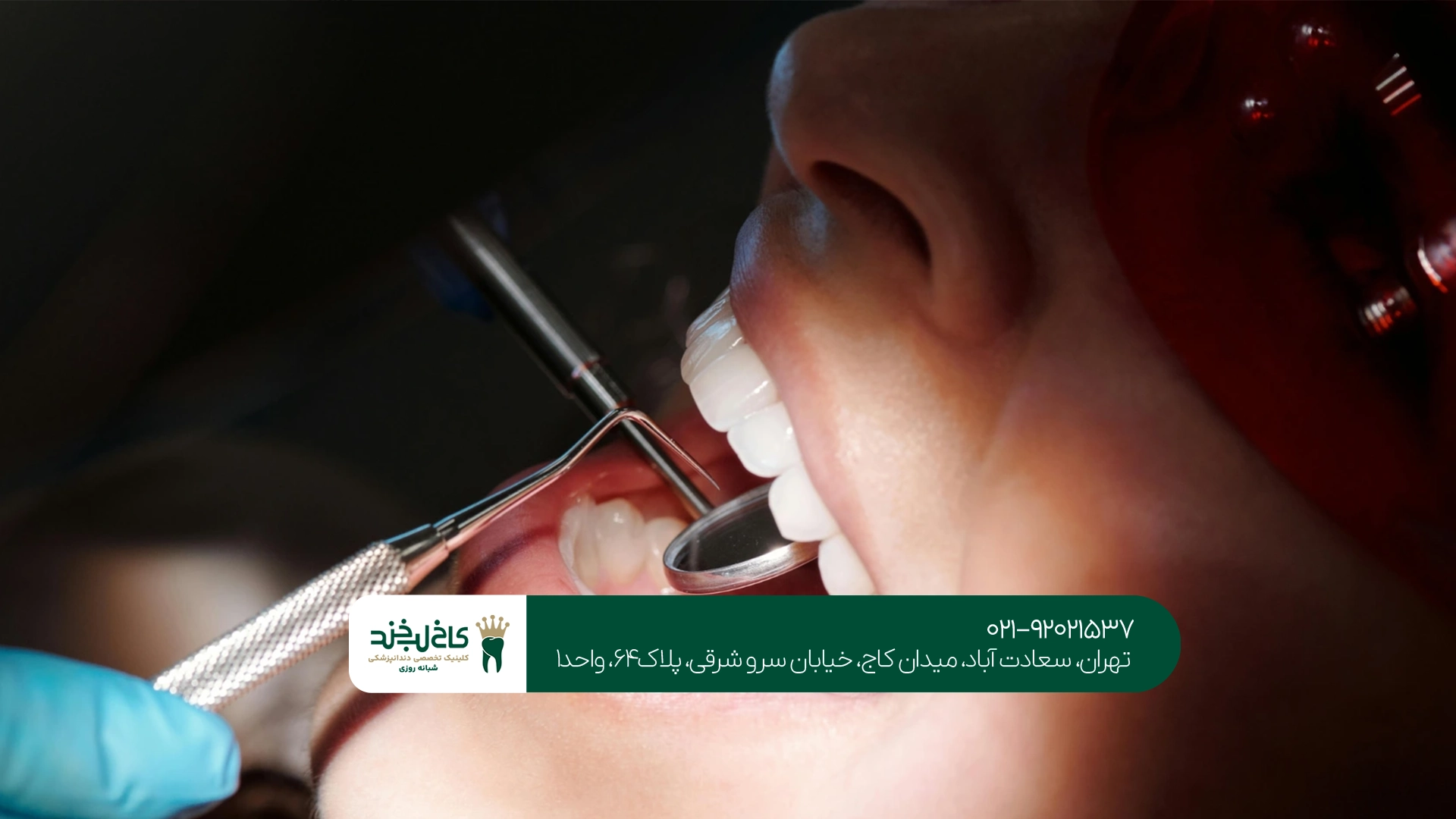 علائم نیاز به جرمگیری دندان علائم نیاز به جرمگیری دندان