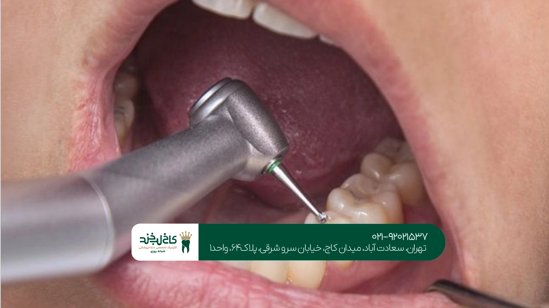 کلینیک درمان ریشه تخصصی