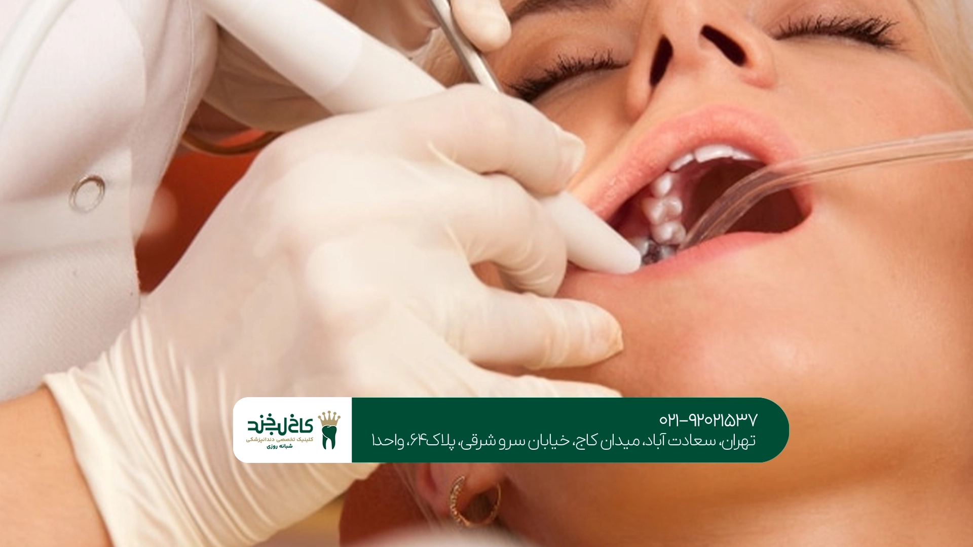 آیا دندان عصبکشیشده دوباره به درمان ریشه نیاز دارد؟