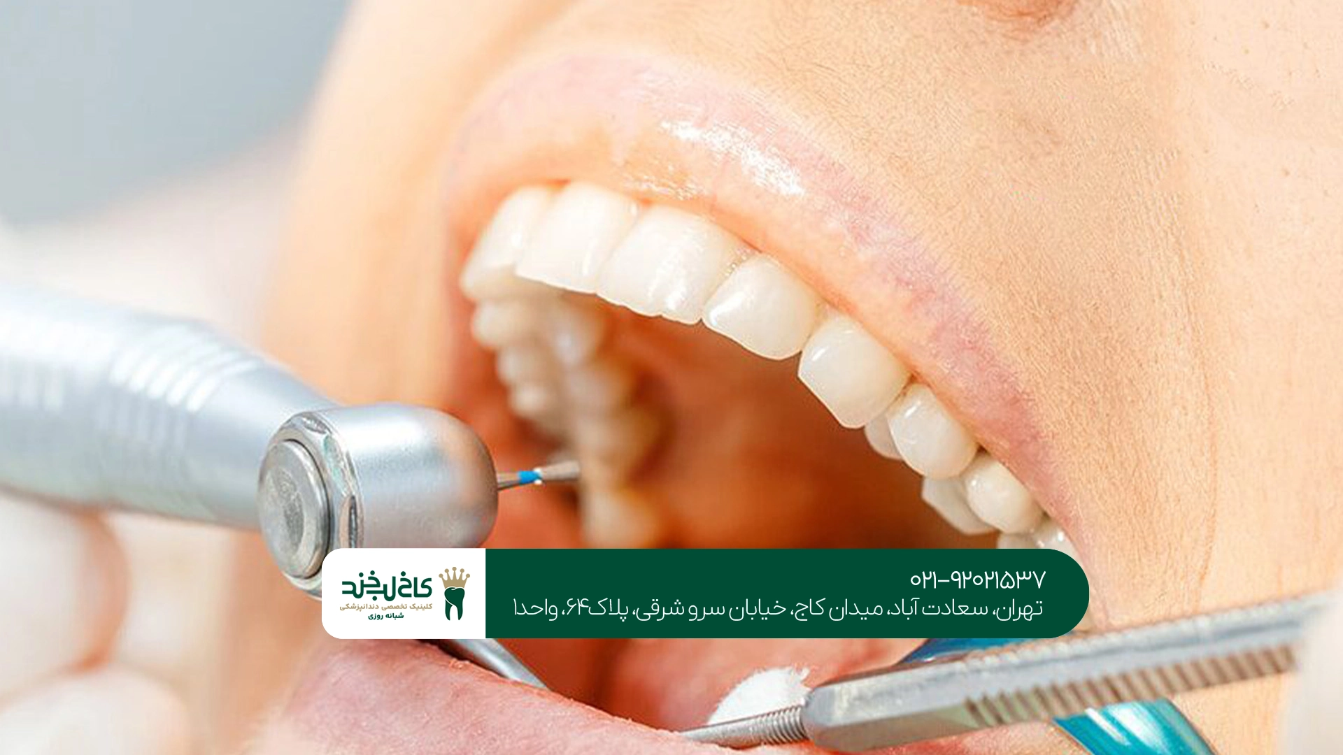 درمان ریشه دندان با روشهای نوین