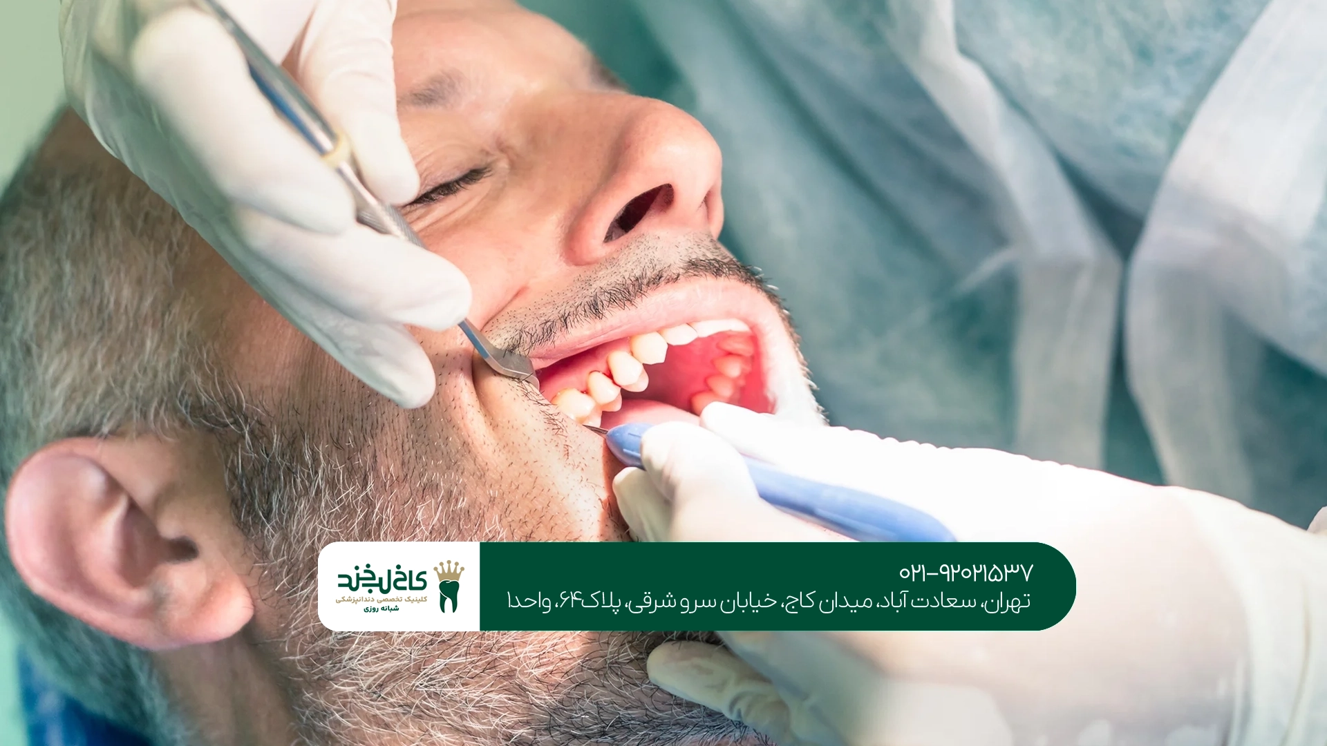 درمان ریشه مجدد سعادت آباد درمان ریشه مجدد سعادت آباد