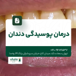 درمان پوسیدگی دندان