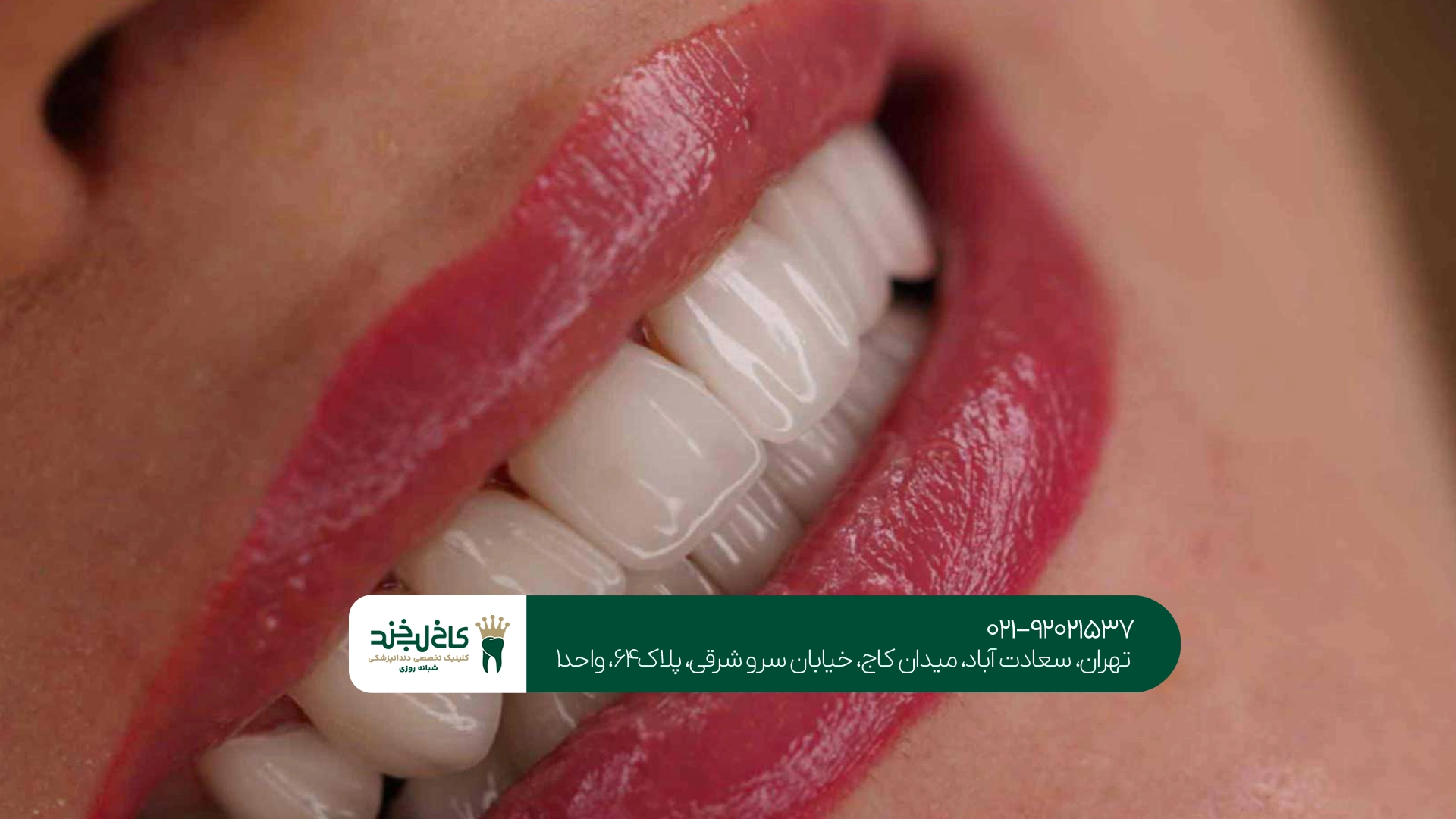 دندانپزشکی تخصصی برای دندان نامرتب