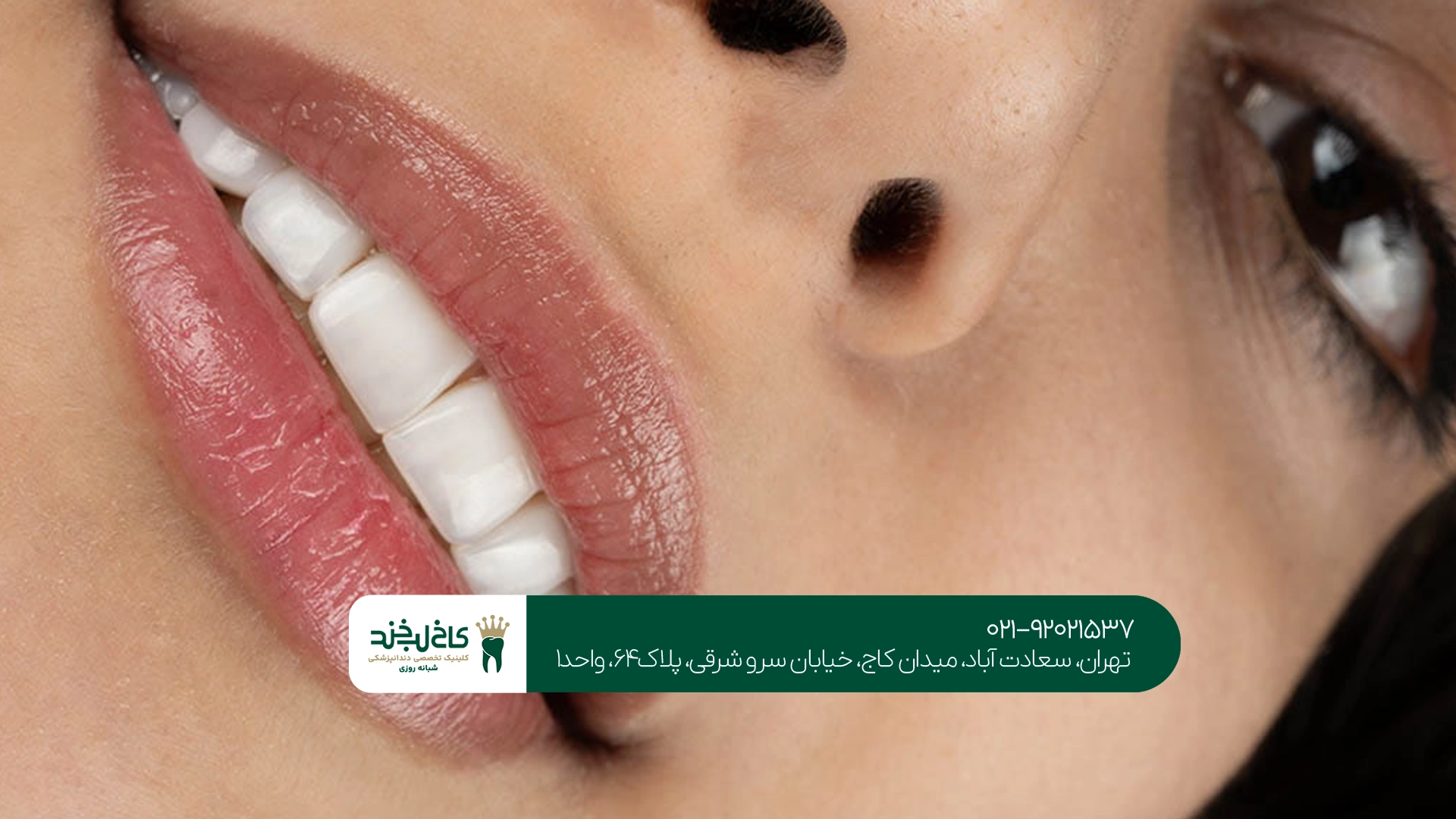 بهترین دندانپزشک برای مرتب کردن دندان