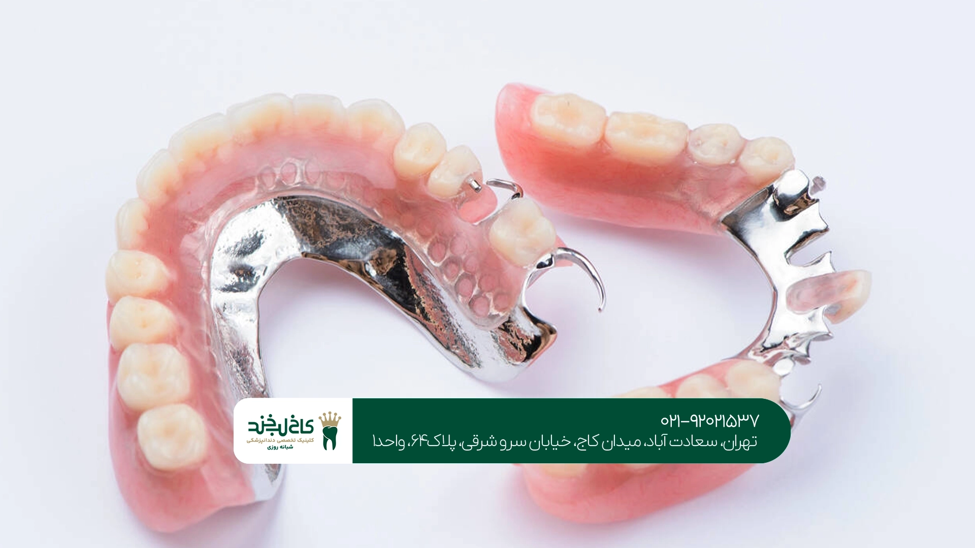دندان مصنوعی تکه ای یا ایمپلنت دندان مصنوعی تکه ای یا ایمپلنت