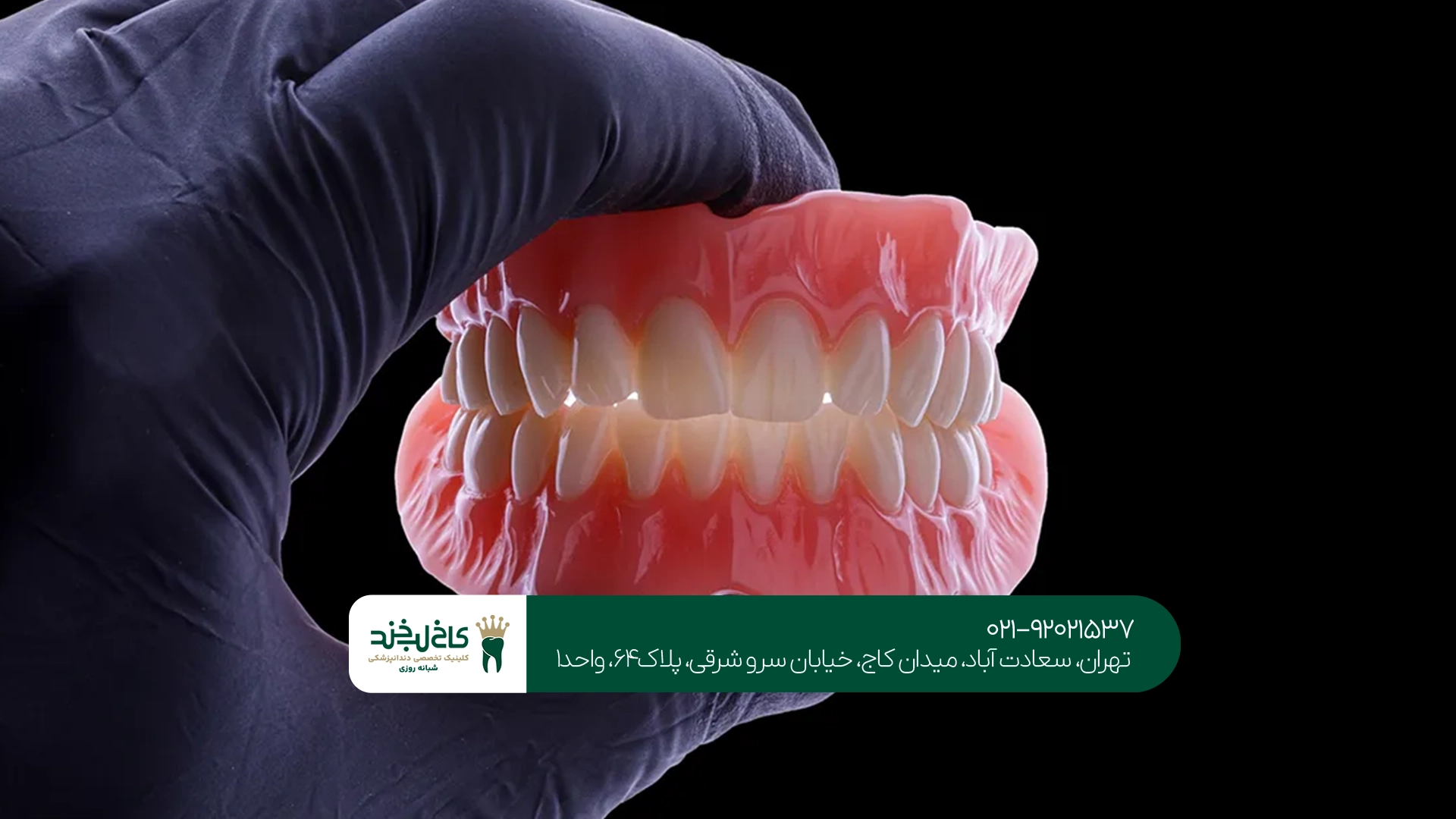 مراحل ساخت دندان مصنوعی دیجیتال در کاخ لبخند مراحل ساخت دندان مصنوعی دیجیتال در کاخ لبخند
