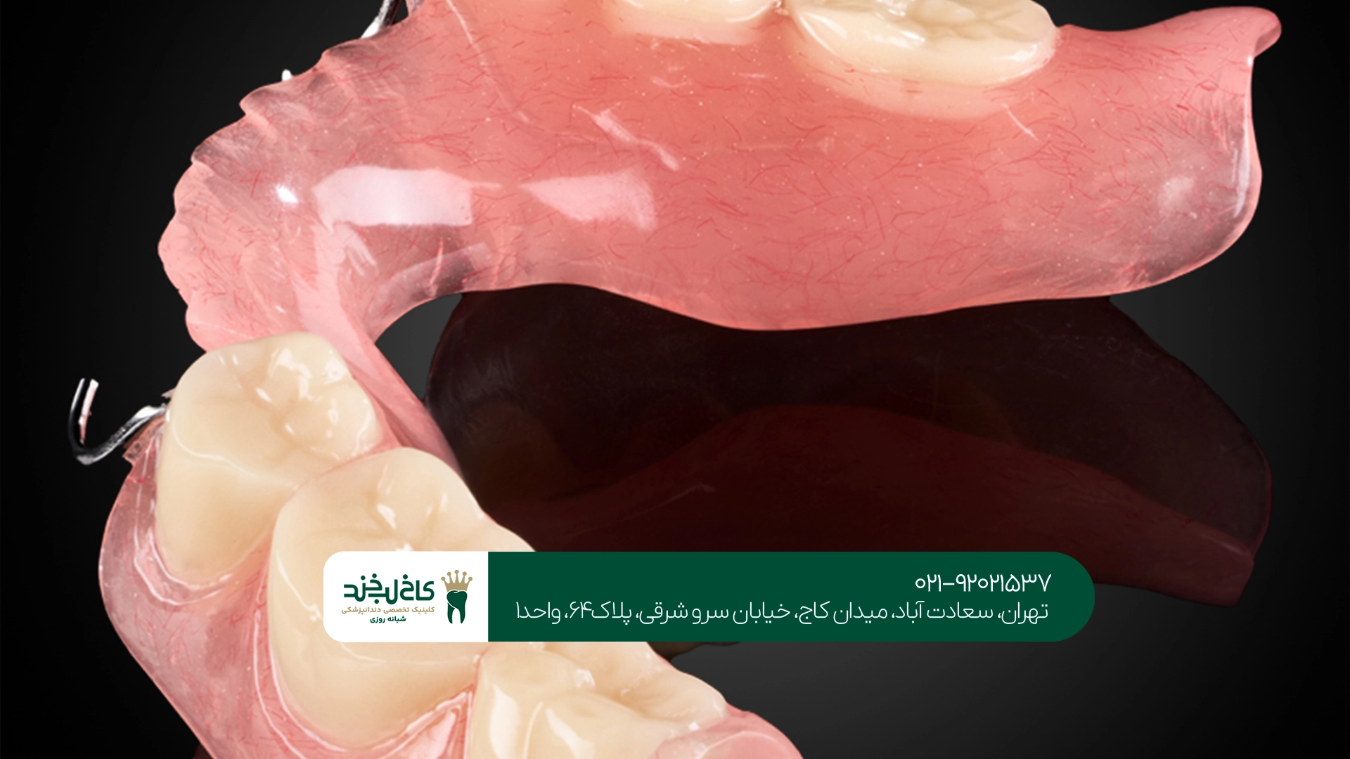 انواع دندان مصنوعی دیجیتال انواع دندان مصنوعی دیجیتال