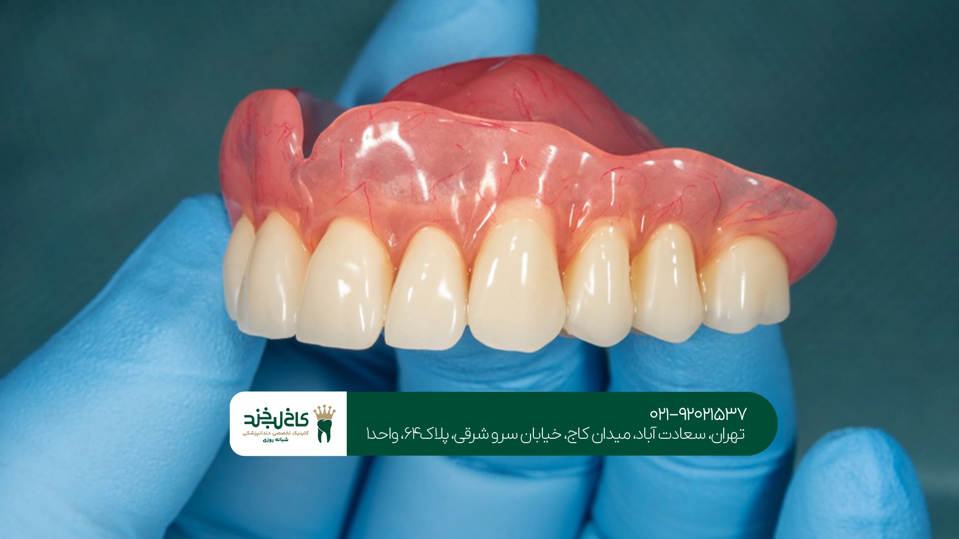چرا دندان مصنوعی دیجیتال انتخاب مناسبی برای بسیاری از افراد است؟ چرا دندان مصنوعی دیجیتال انتخاب مناسبی برای بسیاری از افراد است؟