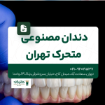 دندان مصنوعی متحرک تهران