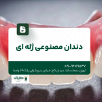 دندان مصنوعی ژله ای