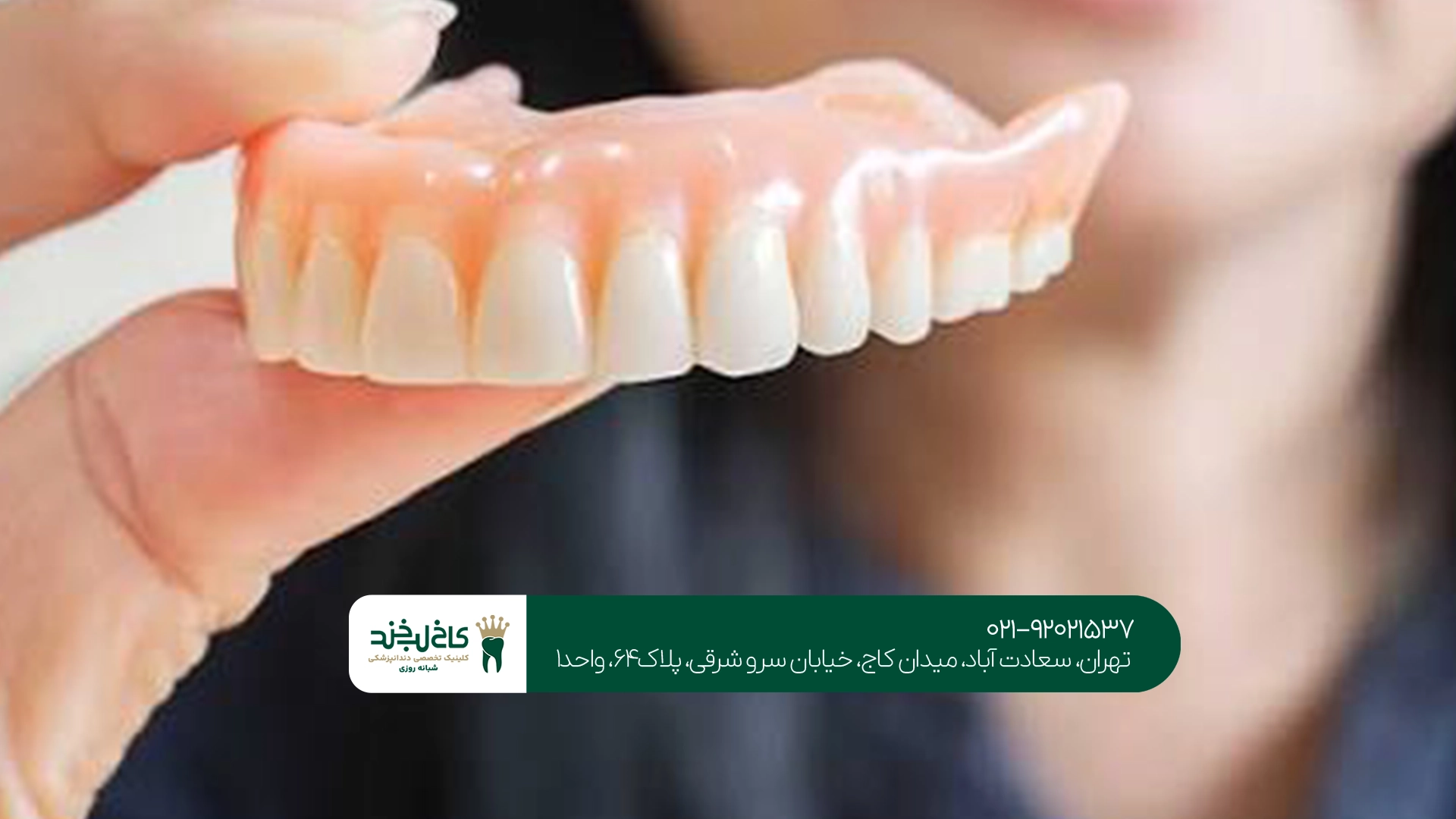 ساخت دندان مصنوعی ژلهای