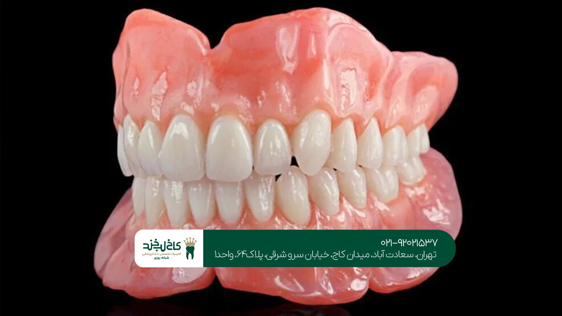 دندان مصنوعی ژلهای در تهران