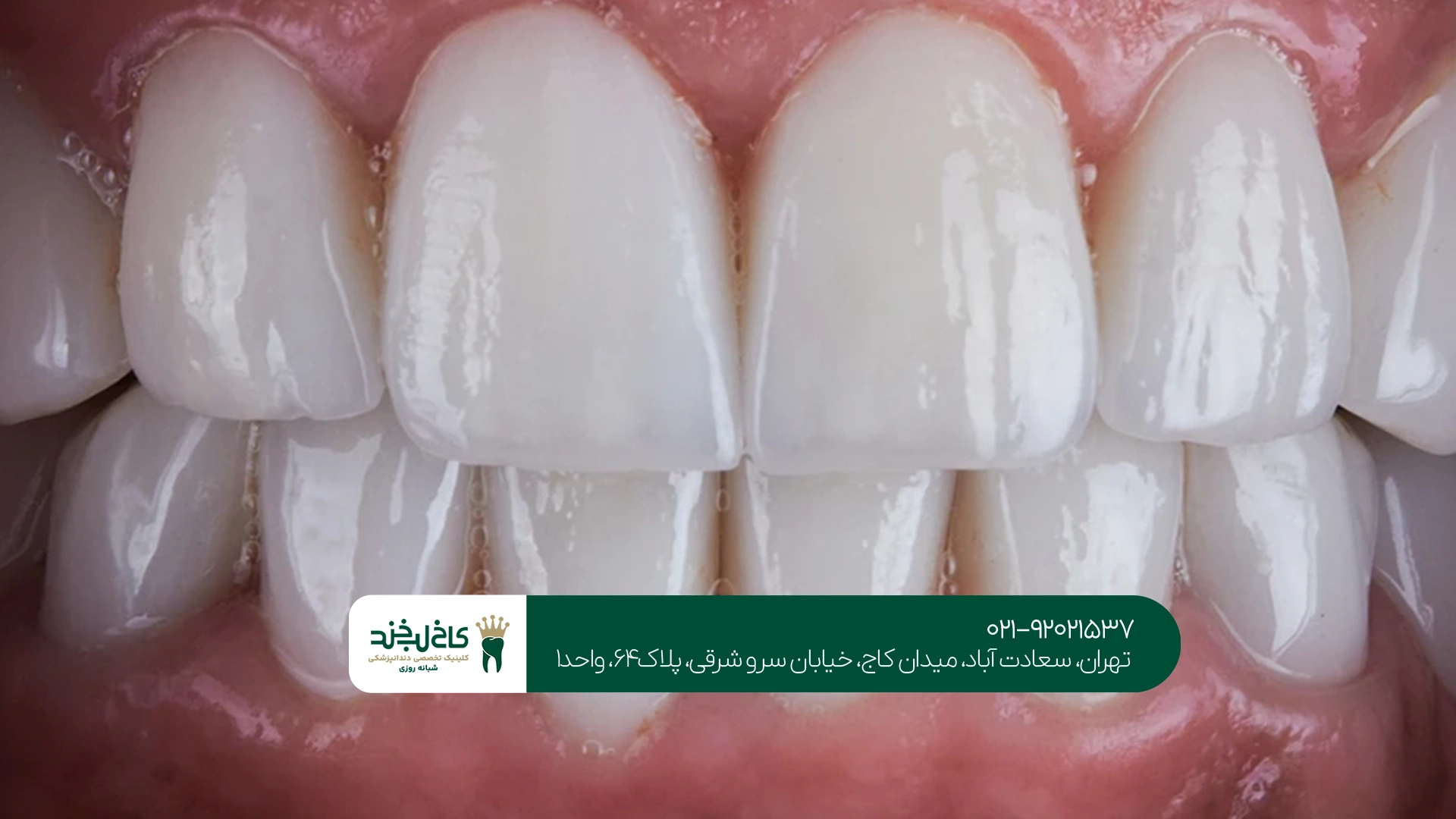 مرکز دندانپزشکی زیبایی تهران