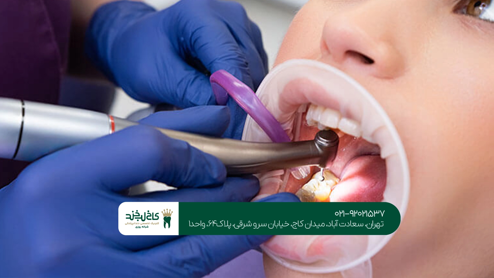 دندانپزشک زیبایی سعادت آباد