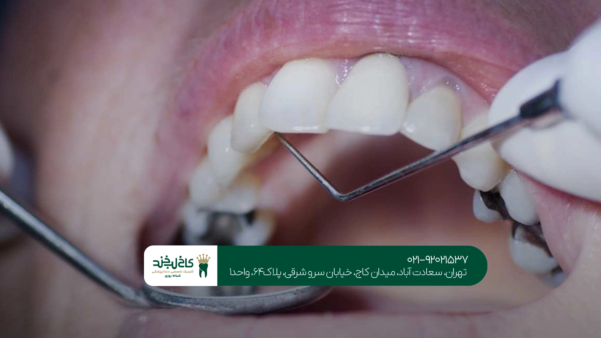 دندانپزشکی اقساطی غرب تهران