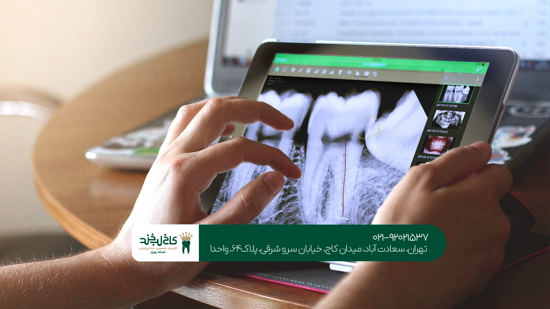 چه درمانهایی با تجهیزات دیجیتال دندانپزشکی انجام میشوند؟