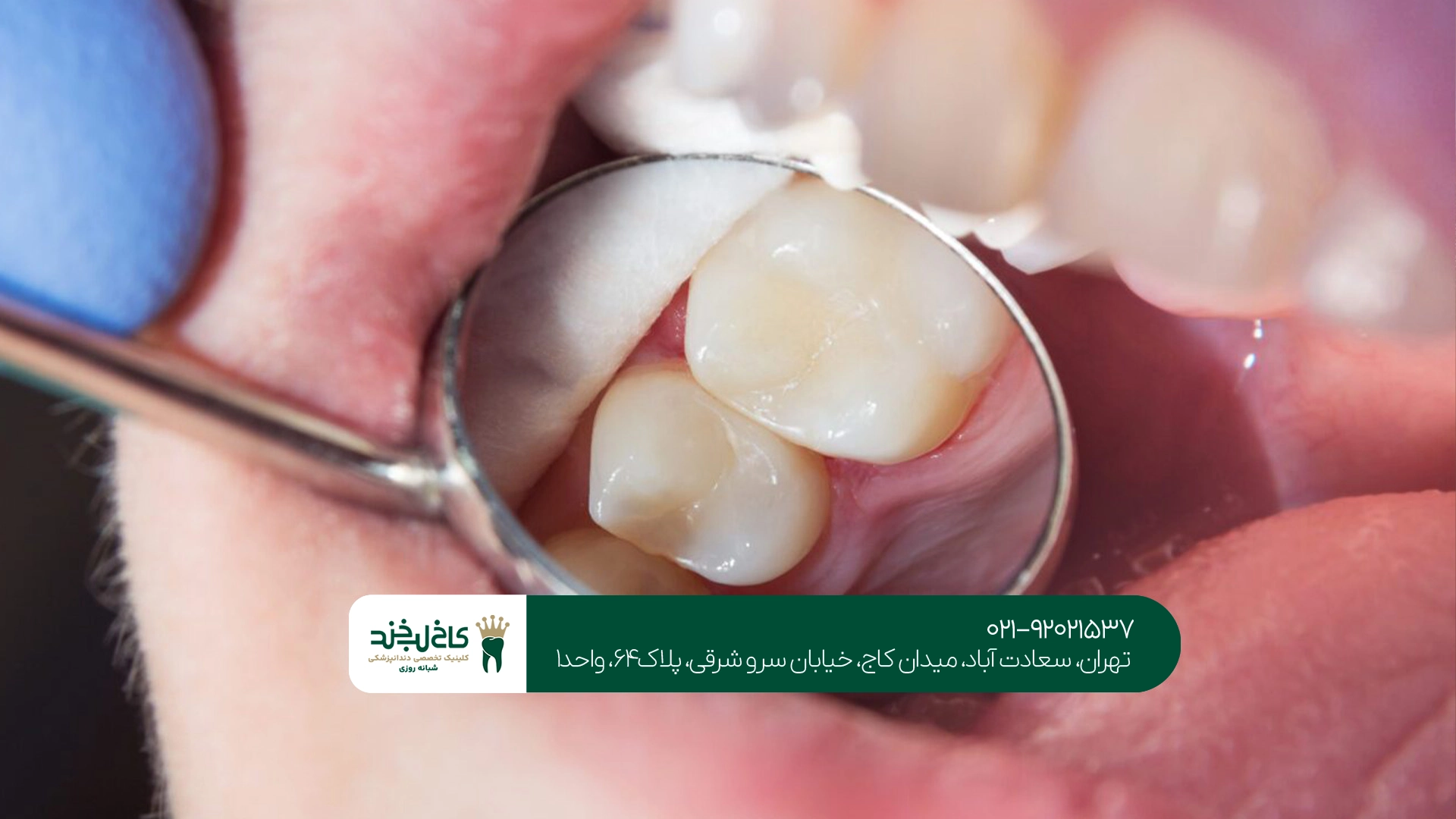 مجهزترین مرکز دندانپزشکی بدون درد شمال تهران
