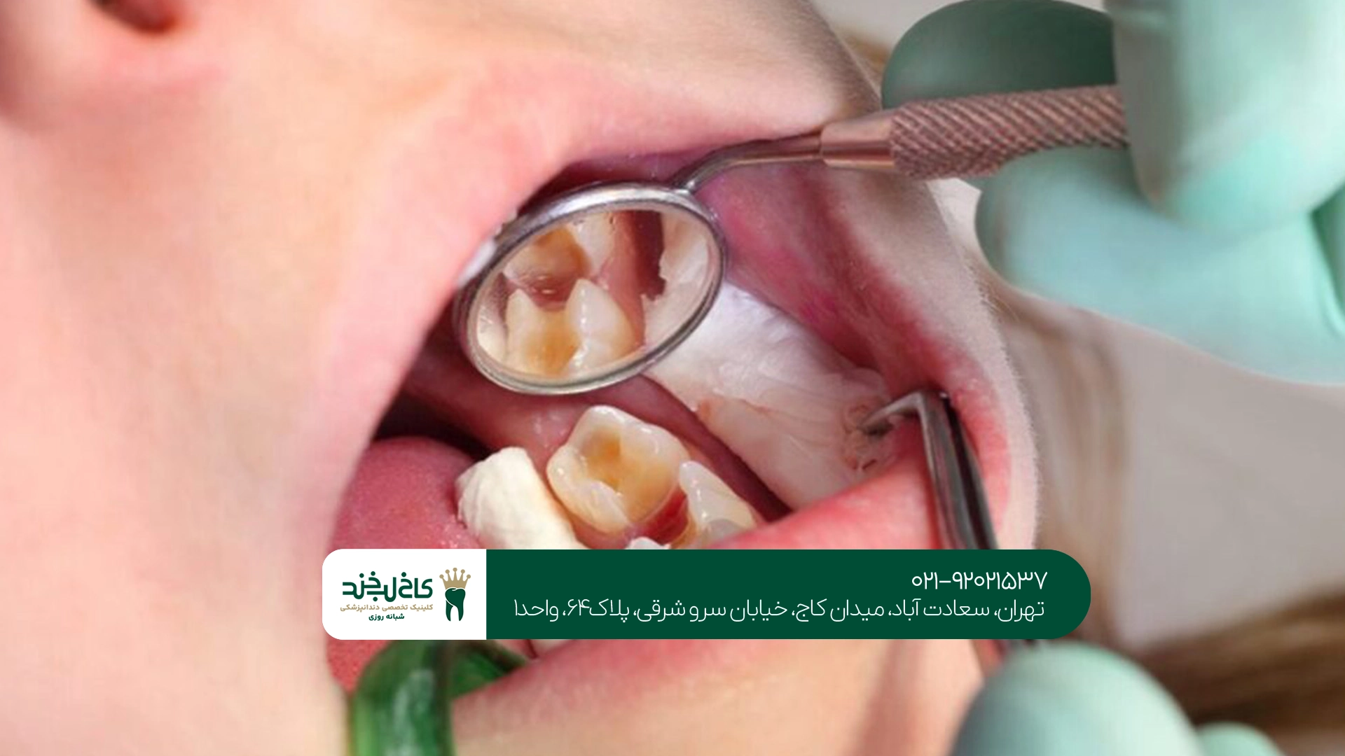 مرکز دندانپزشکی مدرن شمال تهران