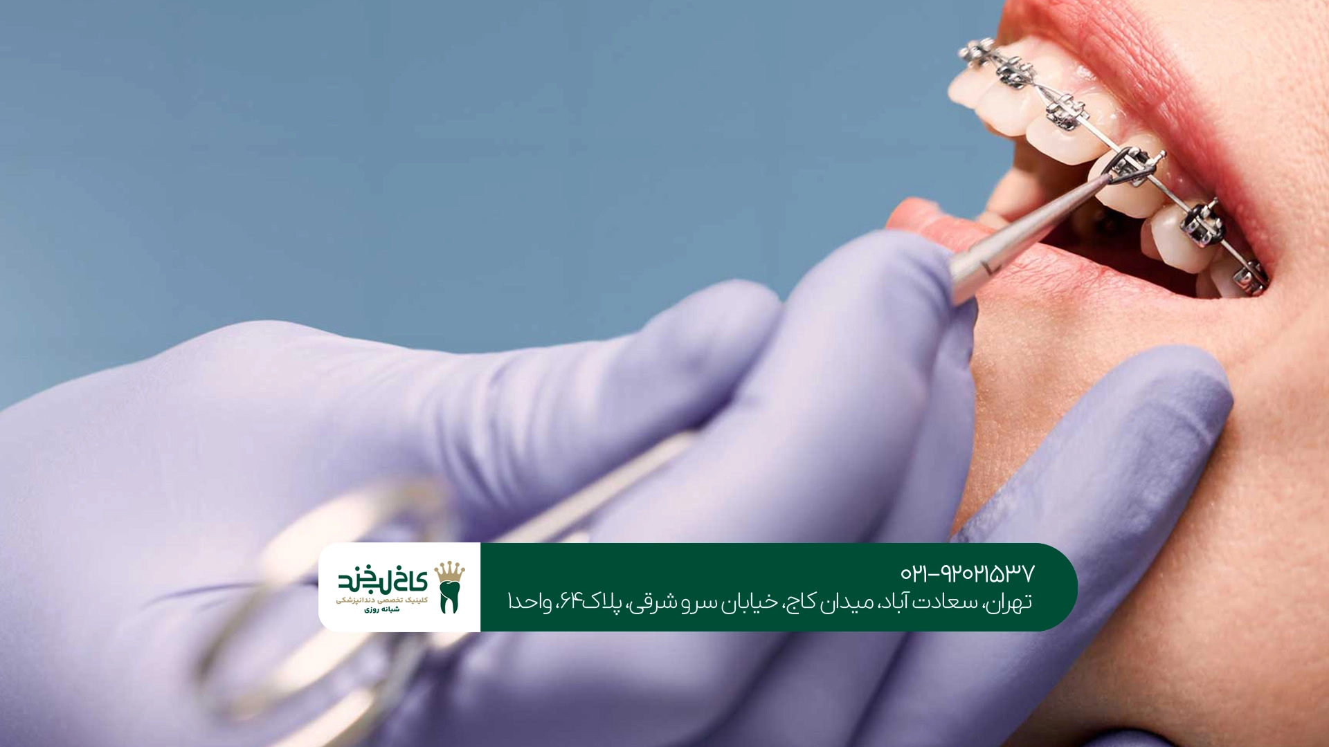 دندانپزشکی خوب تهران
