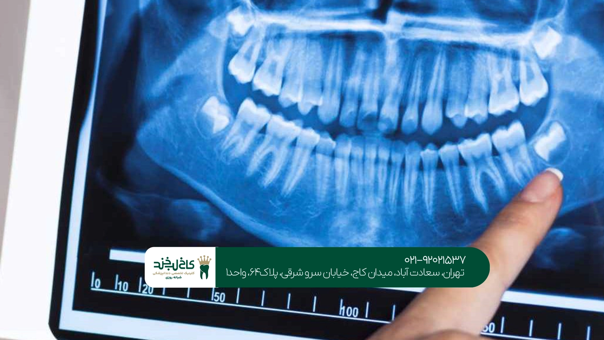 دندانپزشکی دیجیتال دندانپزشکی دیجیتال