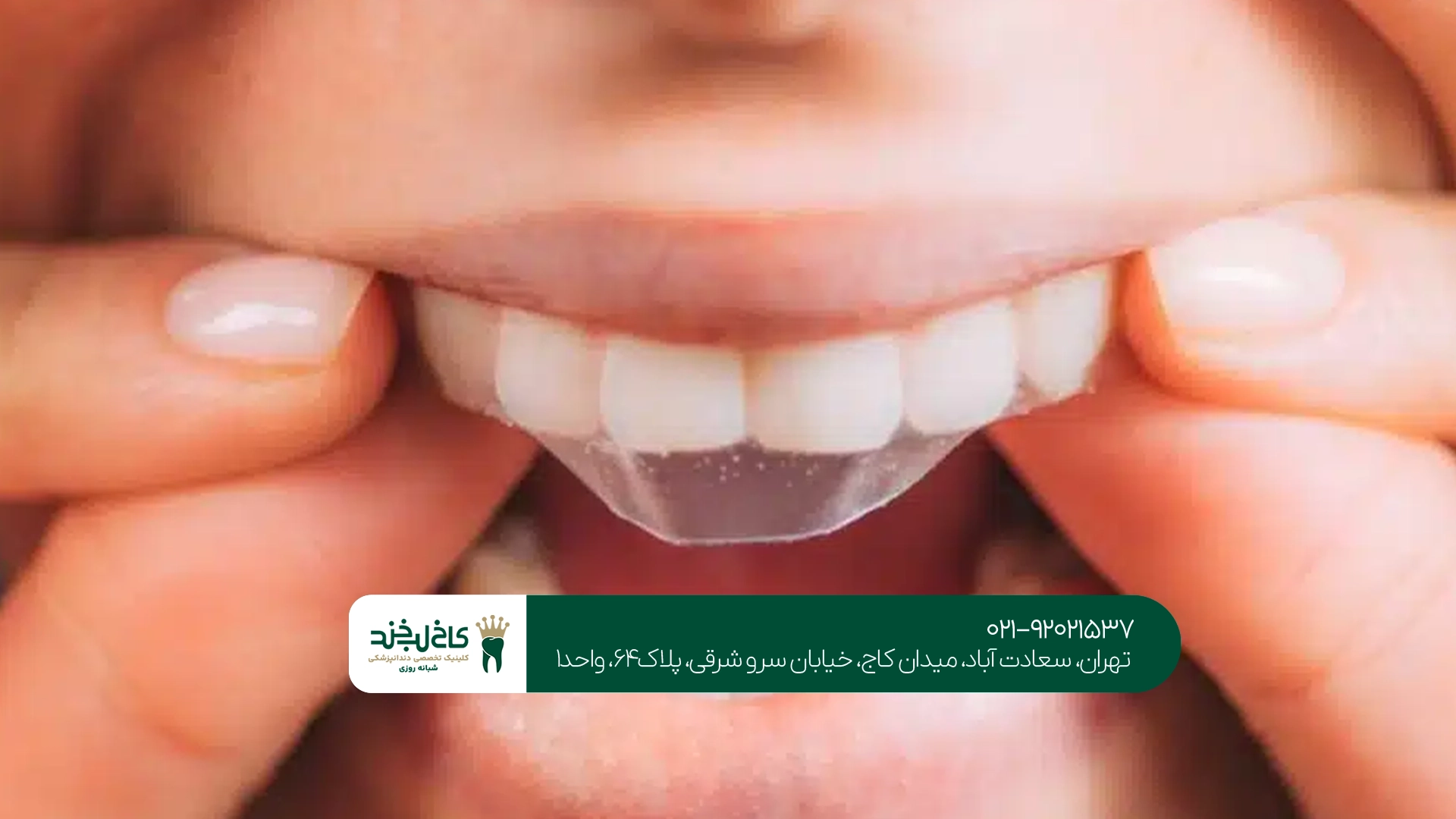 قبل از انتخاب دندانپزشکی زیبایی جنت آباد چه نکاتی را بررسی کنیم؟