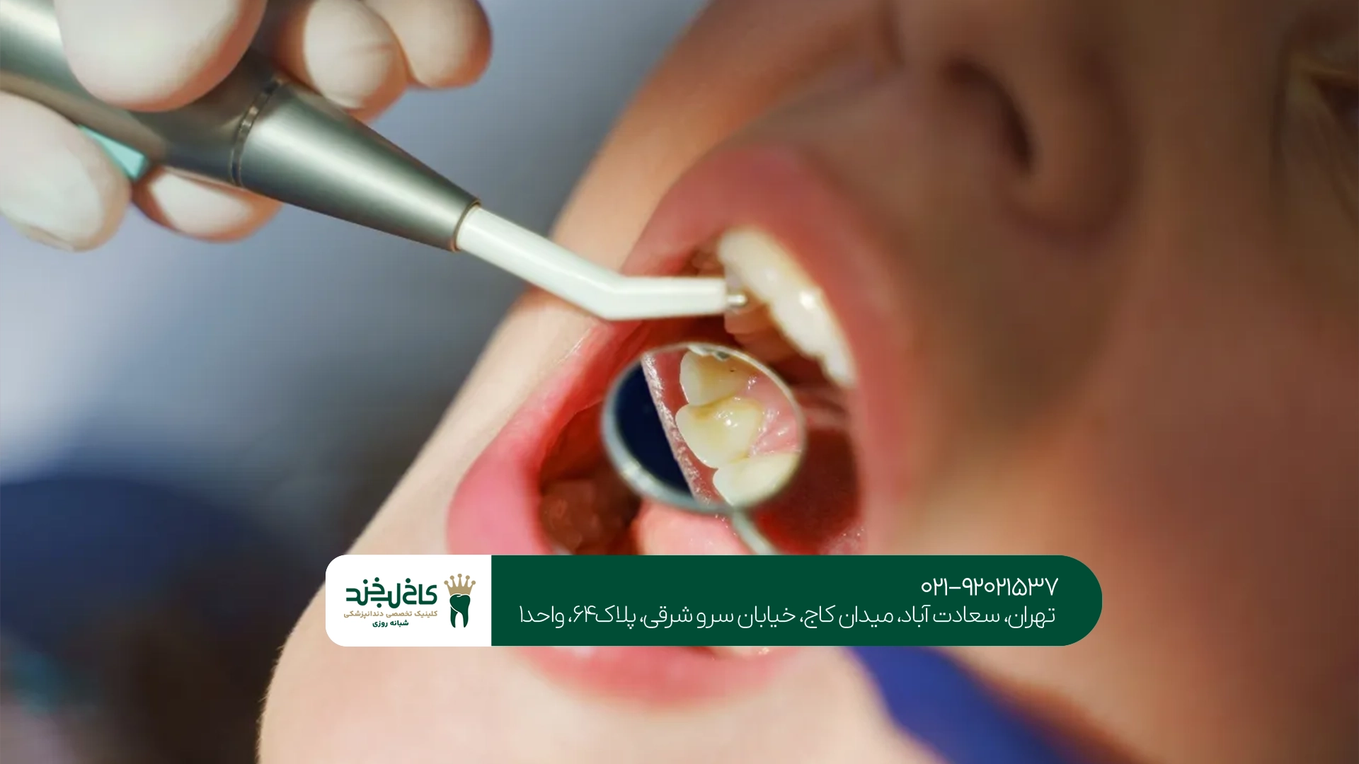 بهترین کلینیک دندانپزشکی ونک بهترین کلینیک دندانپزشکی ونک