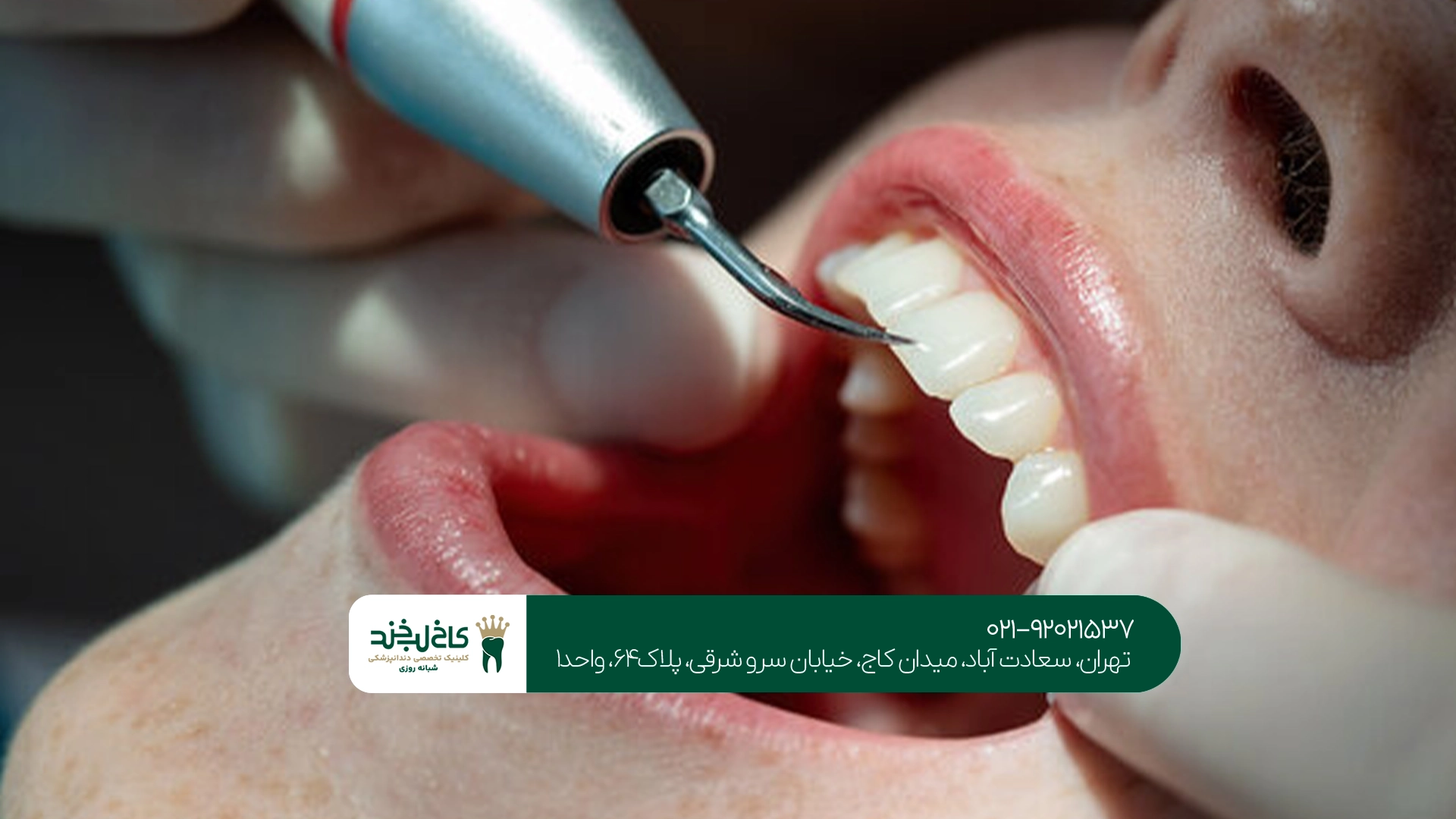 بهترین دندانپزشک ونک بهترین دندانپزشک ونک