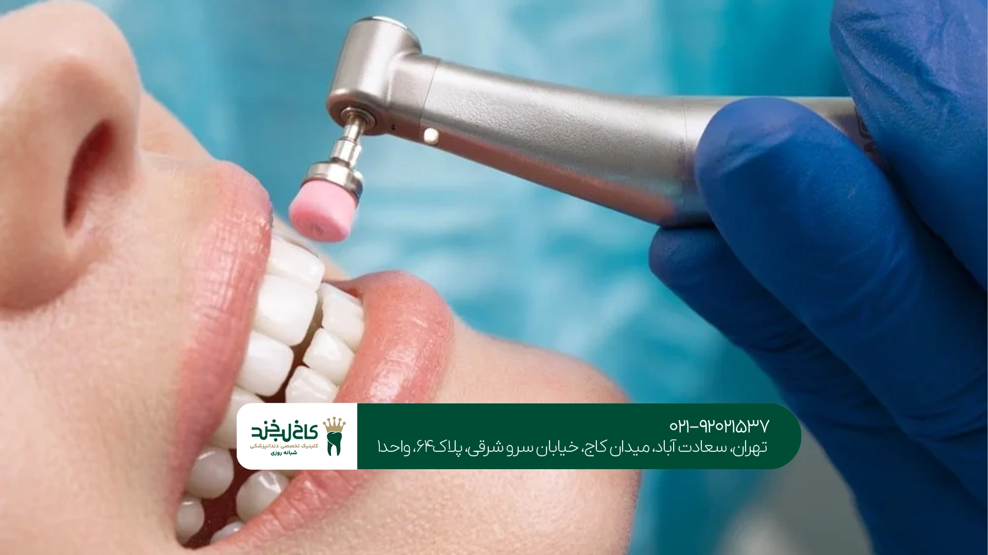 خدمات زیبایی دندان در دندانپزشکی ونک خدمات زیبایی دندان در دندانپزشکی ونک