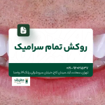 روکش تمام سرامیک