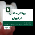 روکش دندان در تهران
