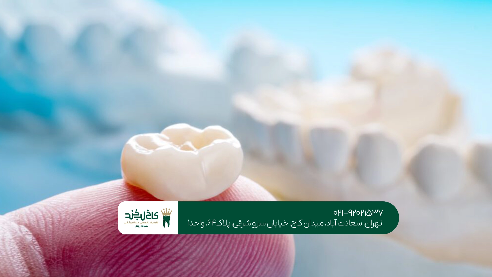 آیا روکش دیجیتال برای همه افراد مناسب است؟ آیا روکش دیجیتال برای همه افراد مناسب است؟