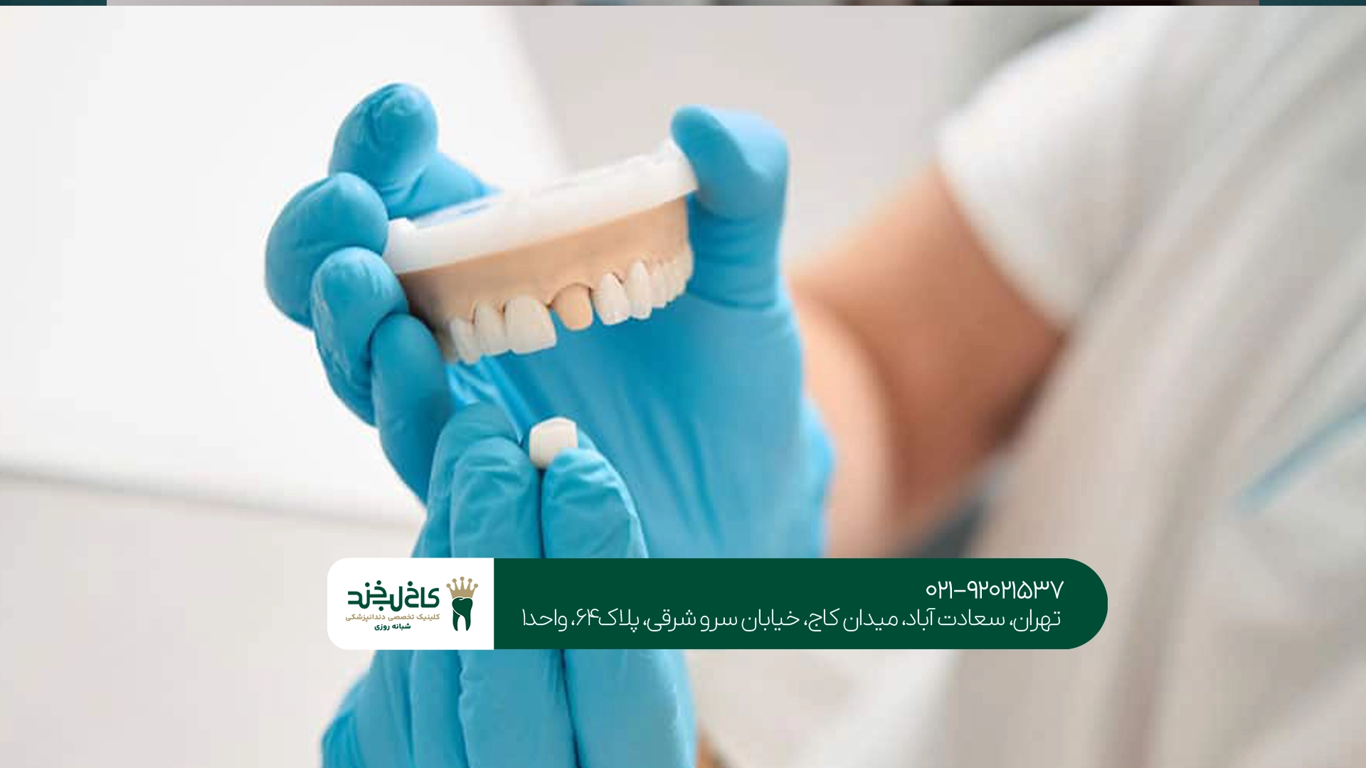 مزایای روکش دندان دیجیتال مزایای روکش دندان دیجیتال