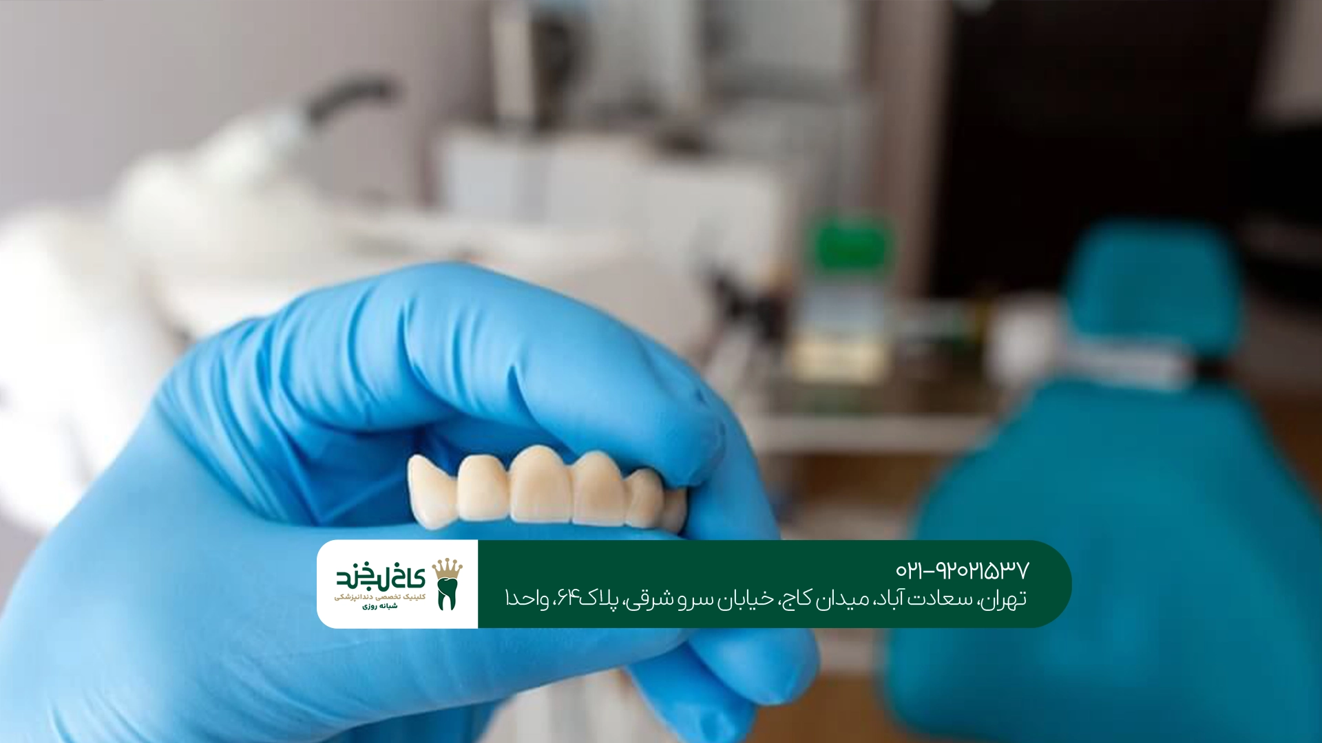 مراحل ساخت روکش دندان دیجیتال مراحل ساخت روکش دندان دیجیتال