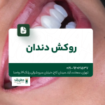 روکش دندان