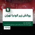 روکش زیرکونیا تهران