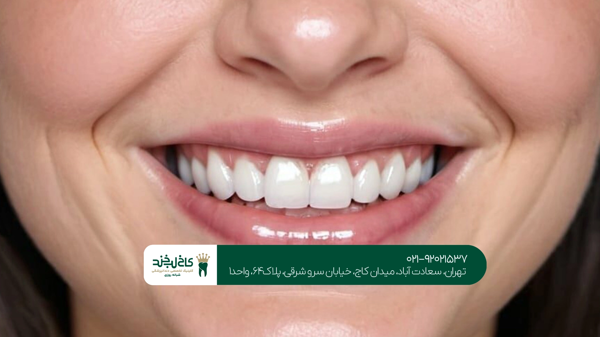 دندانپزشکی زیبایی خوب