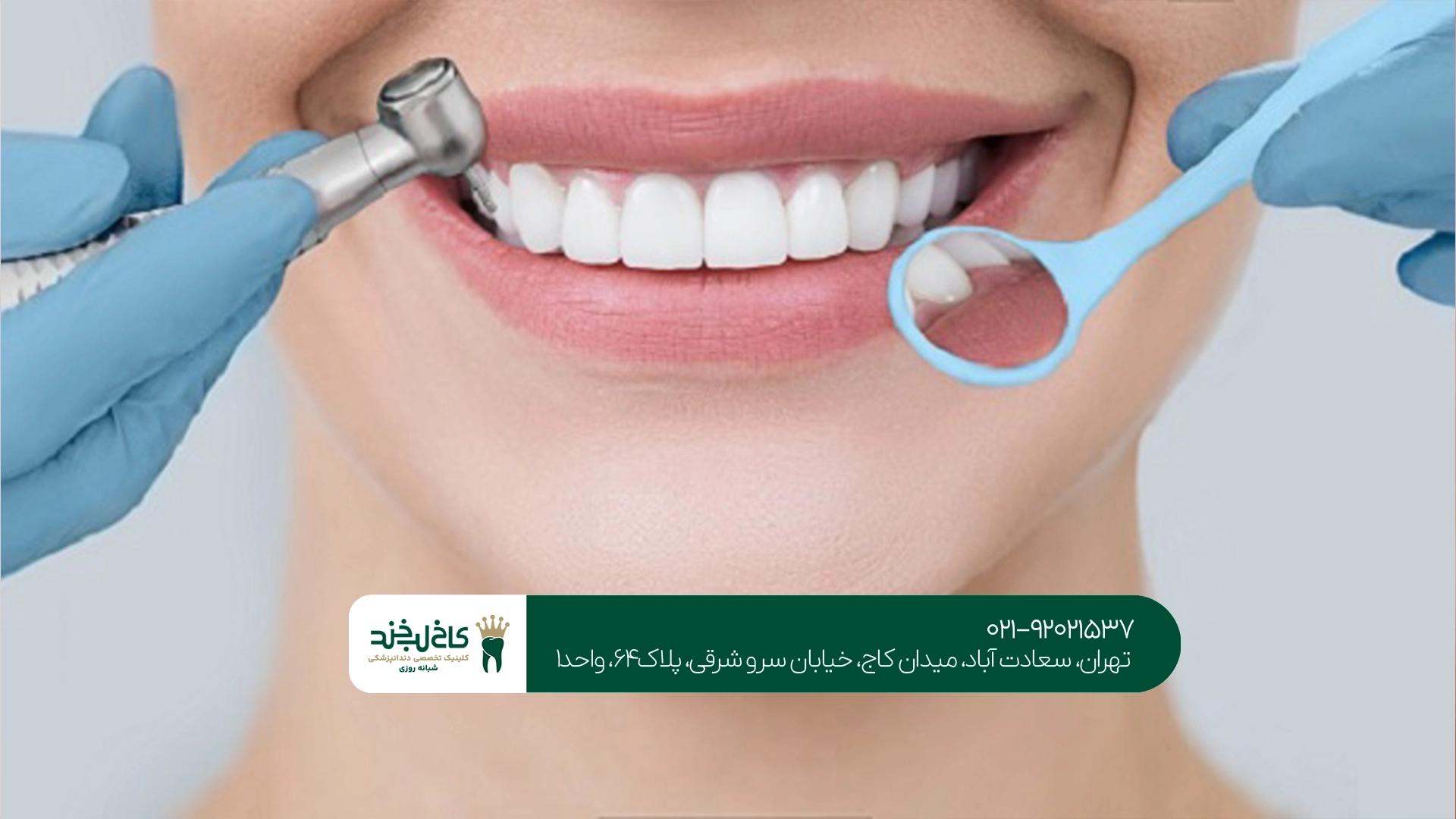 برای زیبایی دندان در تهران به چه نکاتی توجه کنیم؟