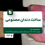 ساخت دندان مصنوعی