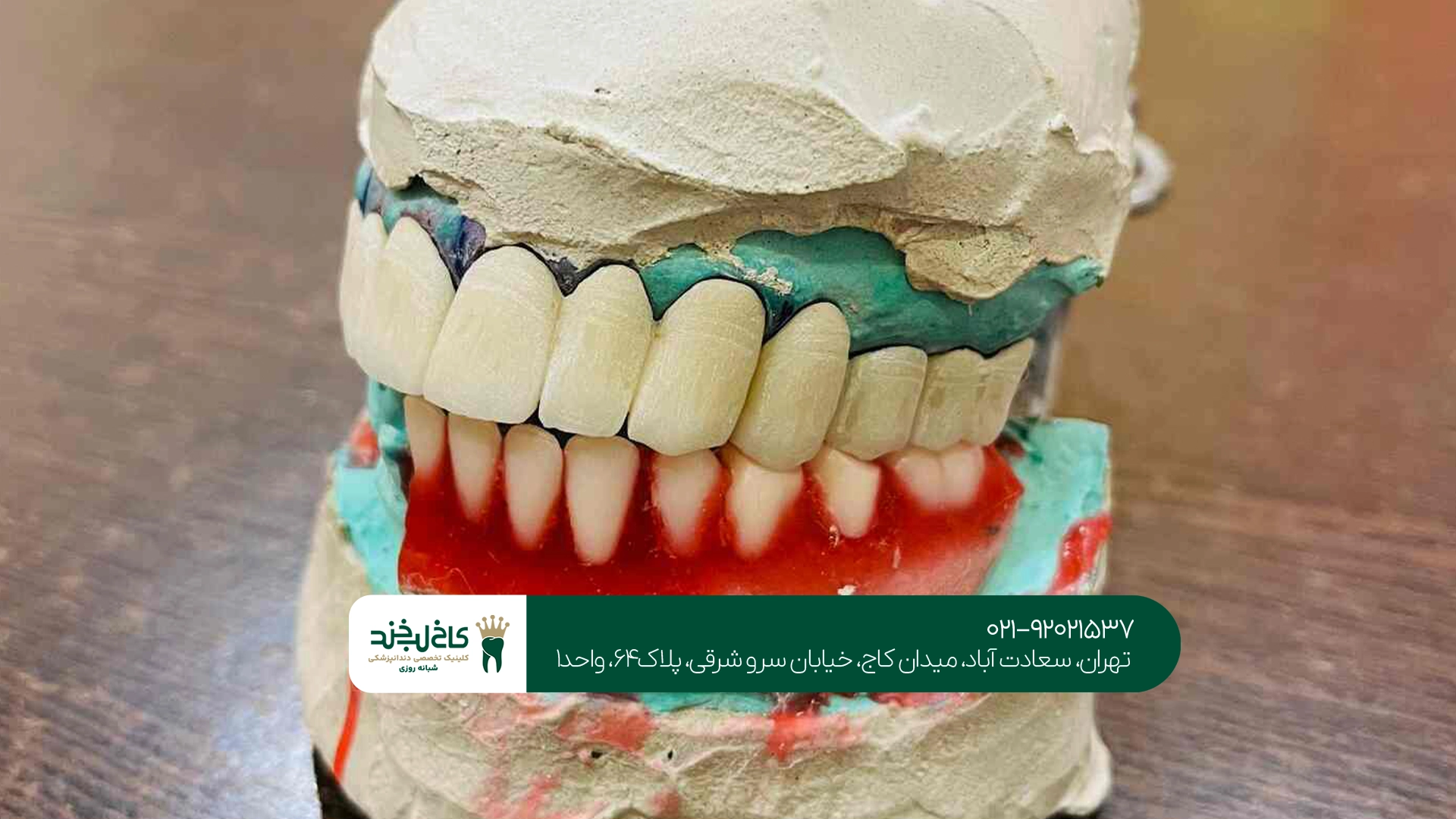 چگونه دندان مصنوعی مناسب انتخاب کنیم؟