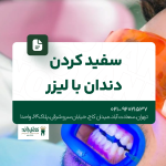 سفید کردن دندان با لیزر