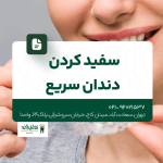 سفید کردن دندان سریع