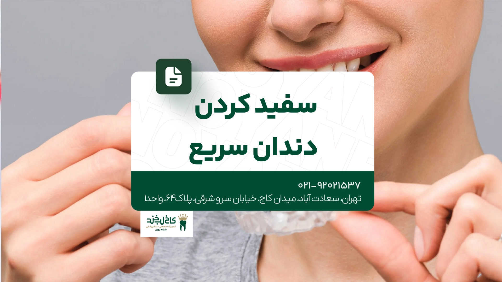 سفید کردن دندان سریع سفید کردن دندان سریع