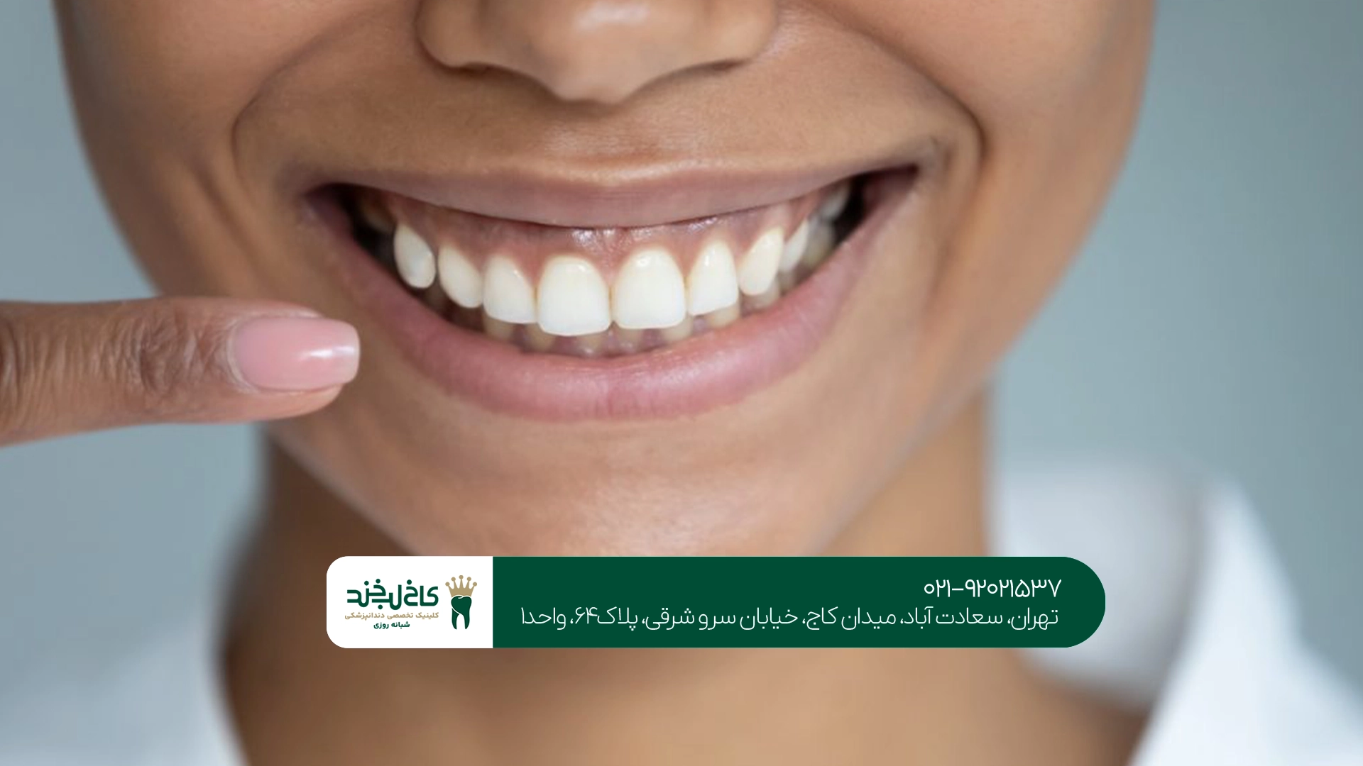 سفید کردن دندان سعادت آباد