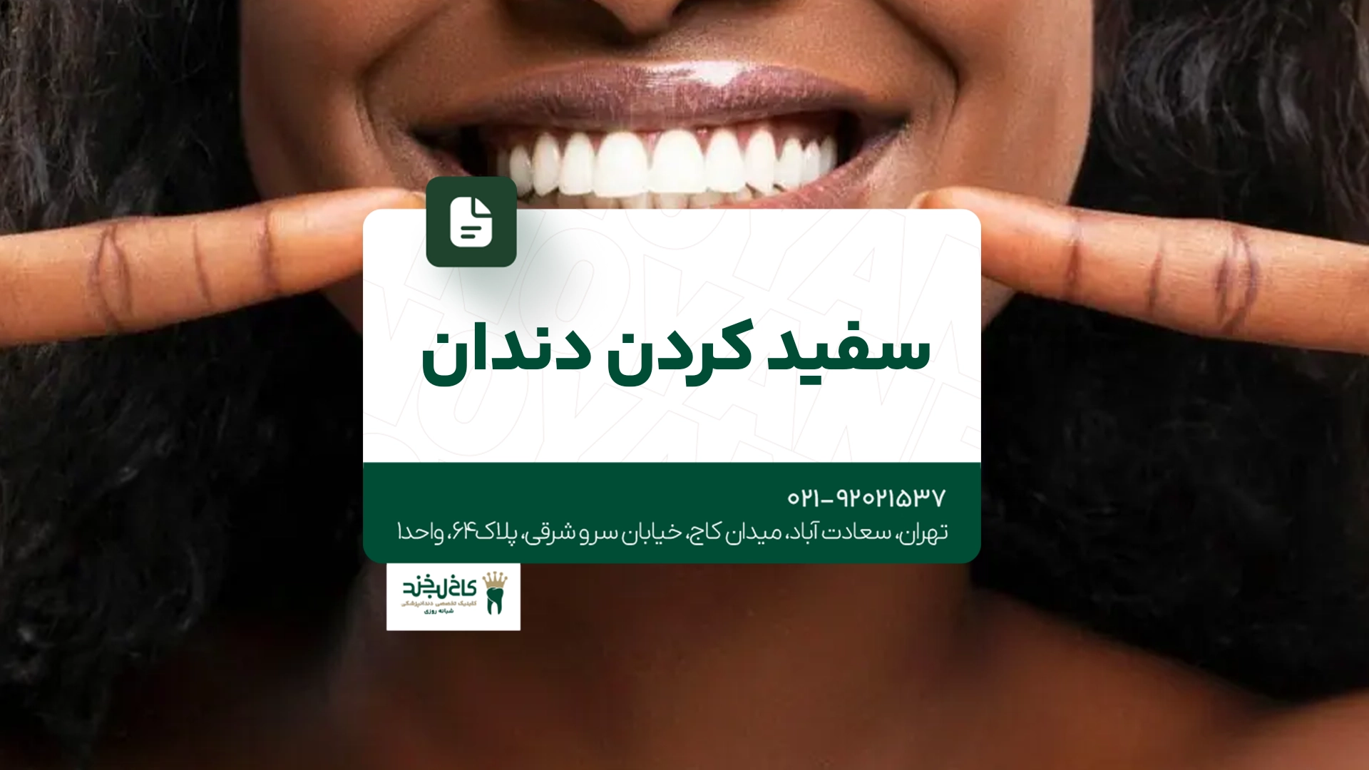 سفید کردن دندان سفید کردن دندان