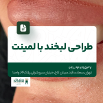 طراحی لبخند با لمینت