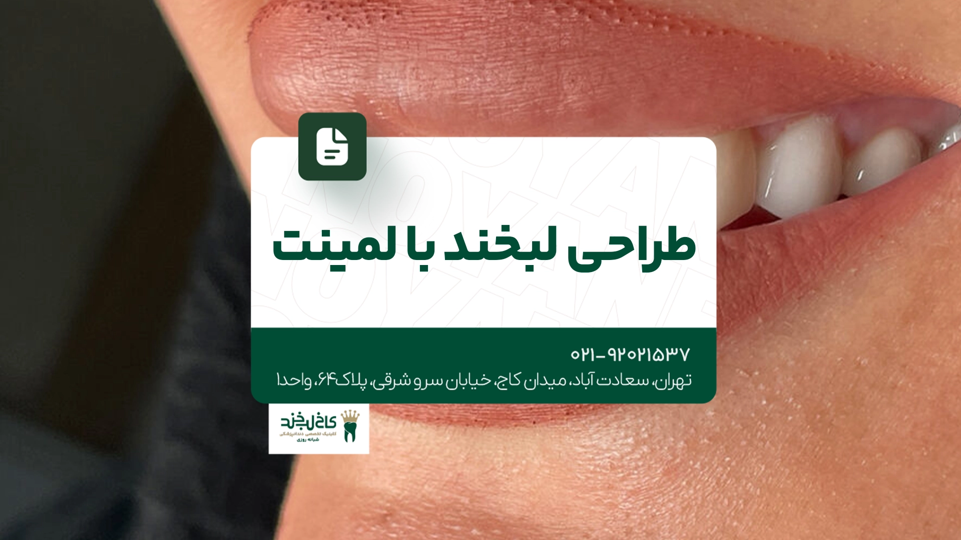 طراحی لبخند با لمینت