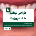 طراحی لبخند با کامپوزیت