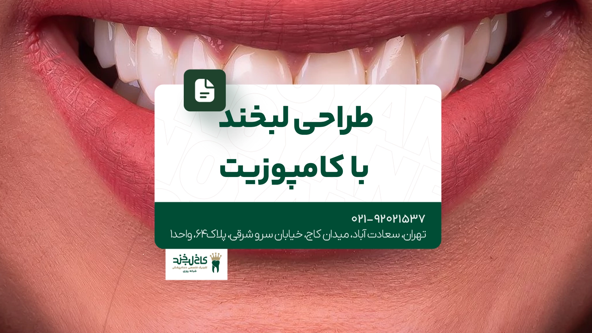 طراحی لبخند با کامپوزیت