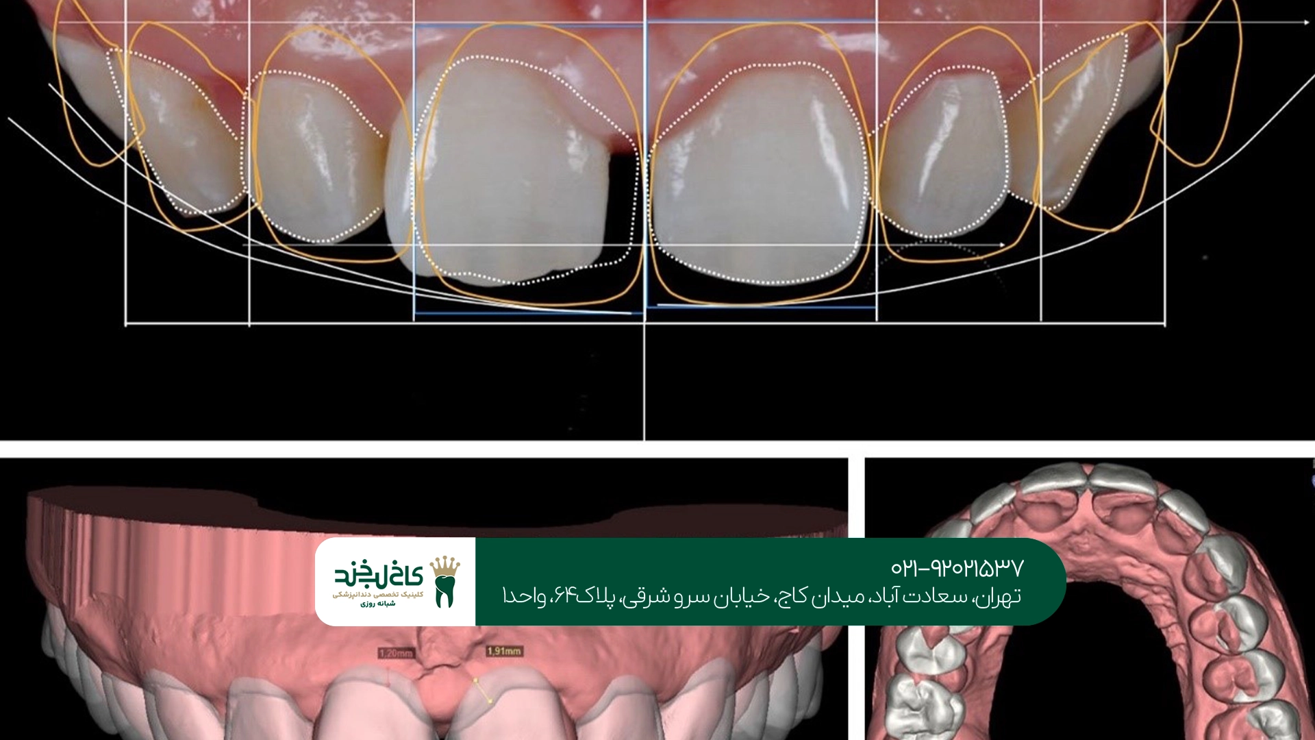 طراحی لبخند دیجیتال حرفهای