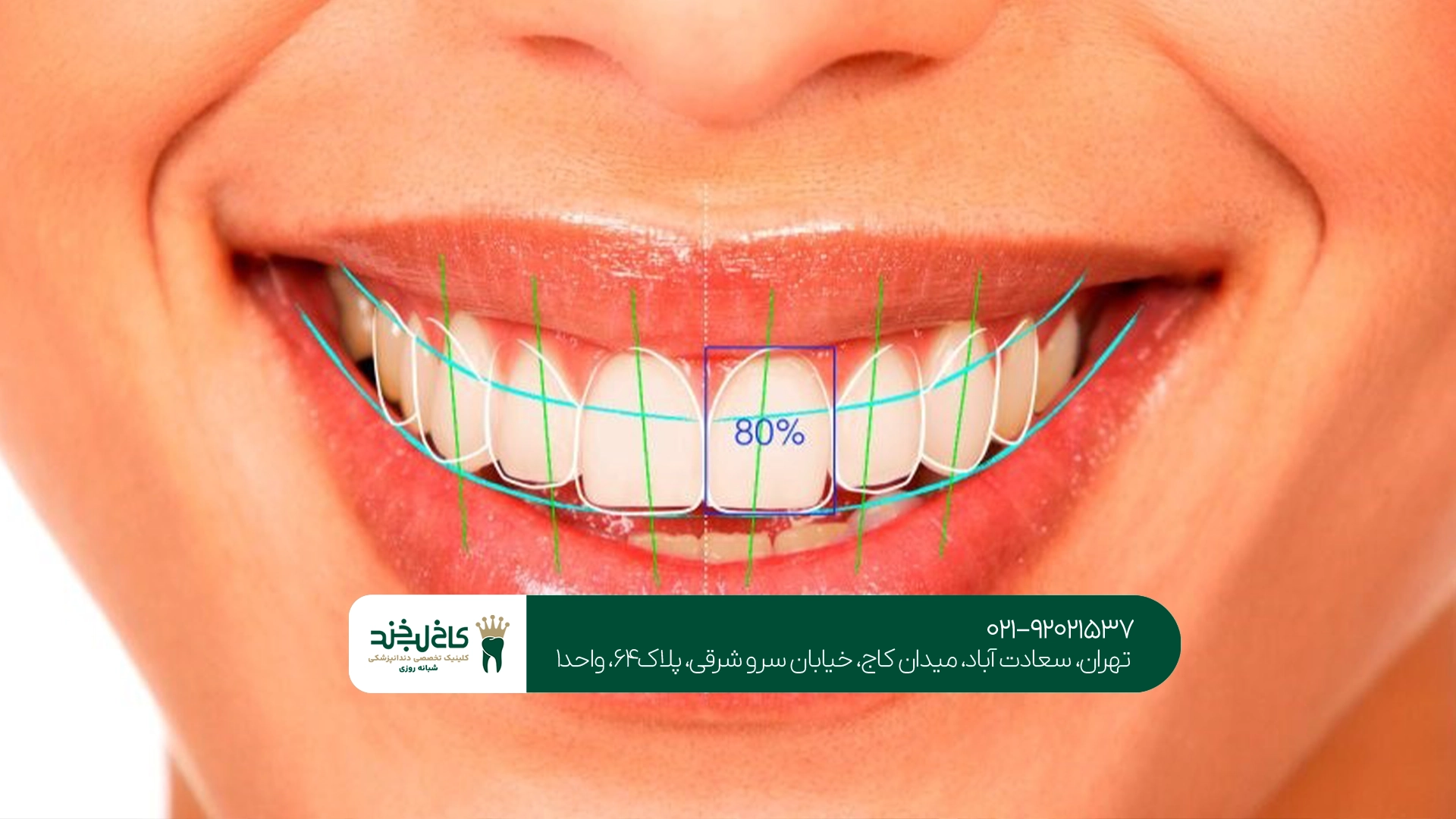 بهترین کلینیک طراحی لبخند دیجیتال